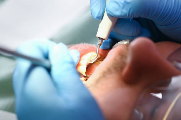 Best Emergency Broken Tooth Repair in Hope Valley, RI