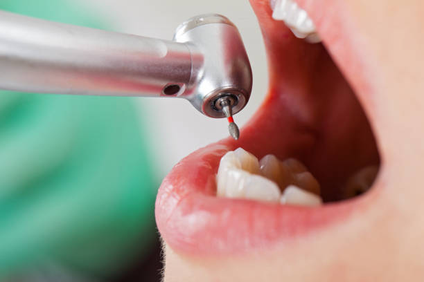 Best Weekend Emergency Dentist in Hope Valley, RI